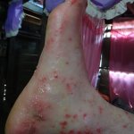 Samar, Filipini 5.4.2017